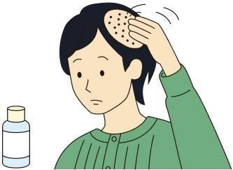 血行促進作用のある外用薬をぬる治療方法
